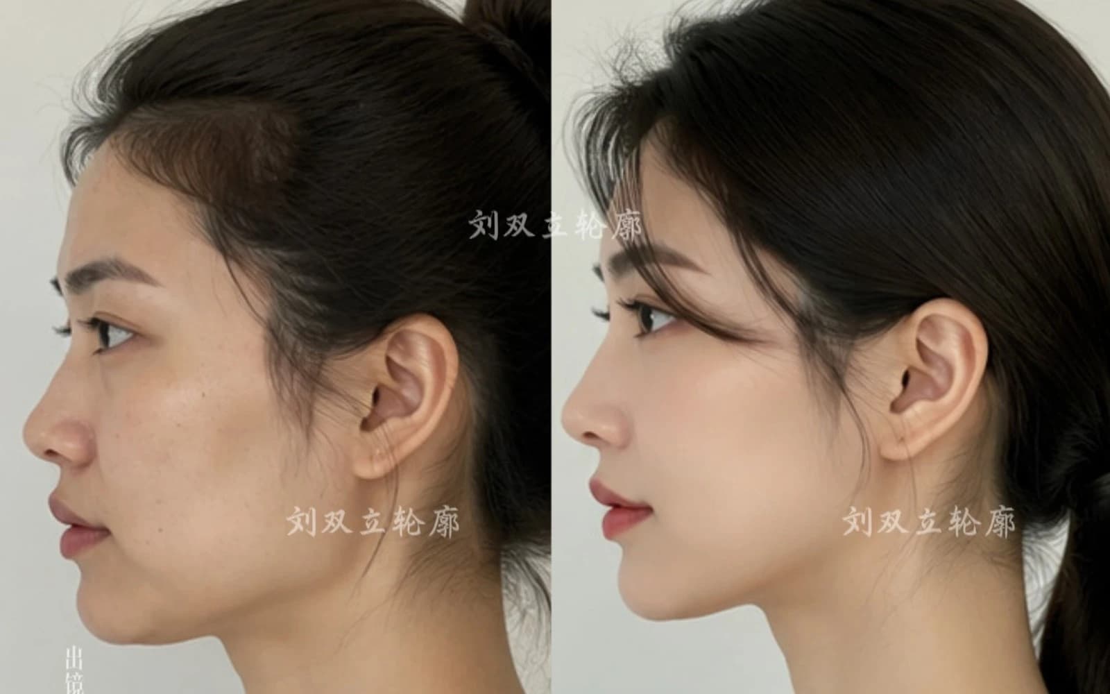 Supplied before and after comparison for Case 02
