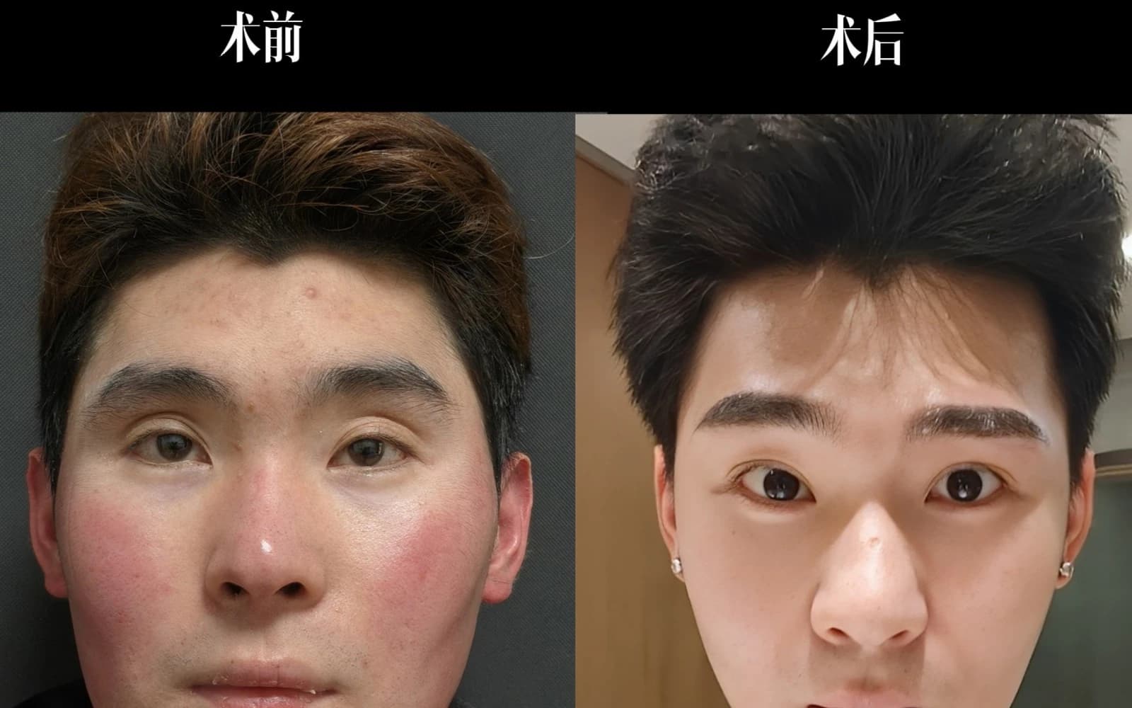 Supplied before and after comparison for Case 04