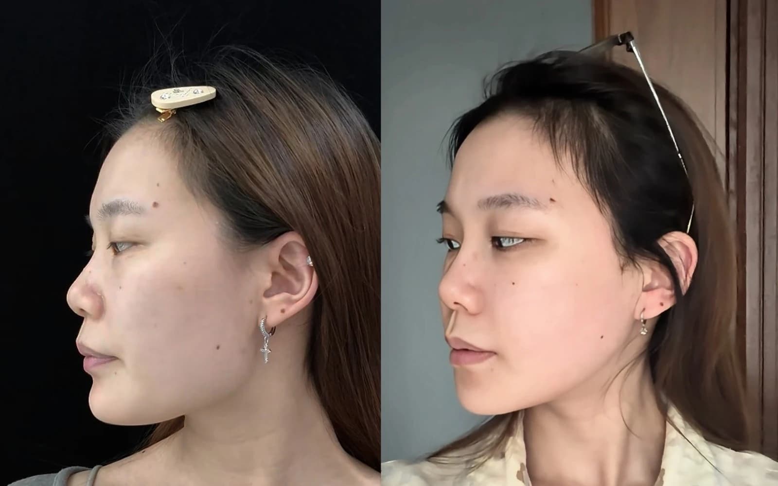 Supplied before and after comparison for Case 05
