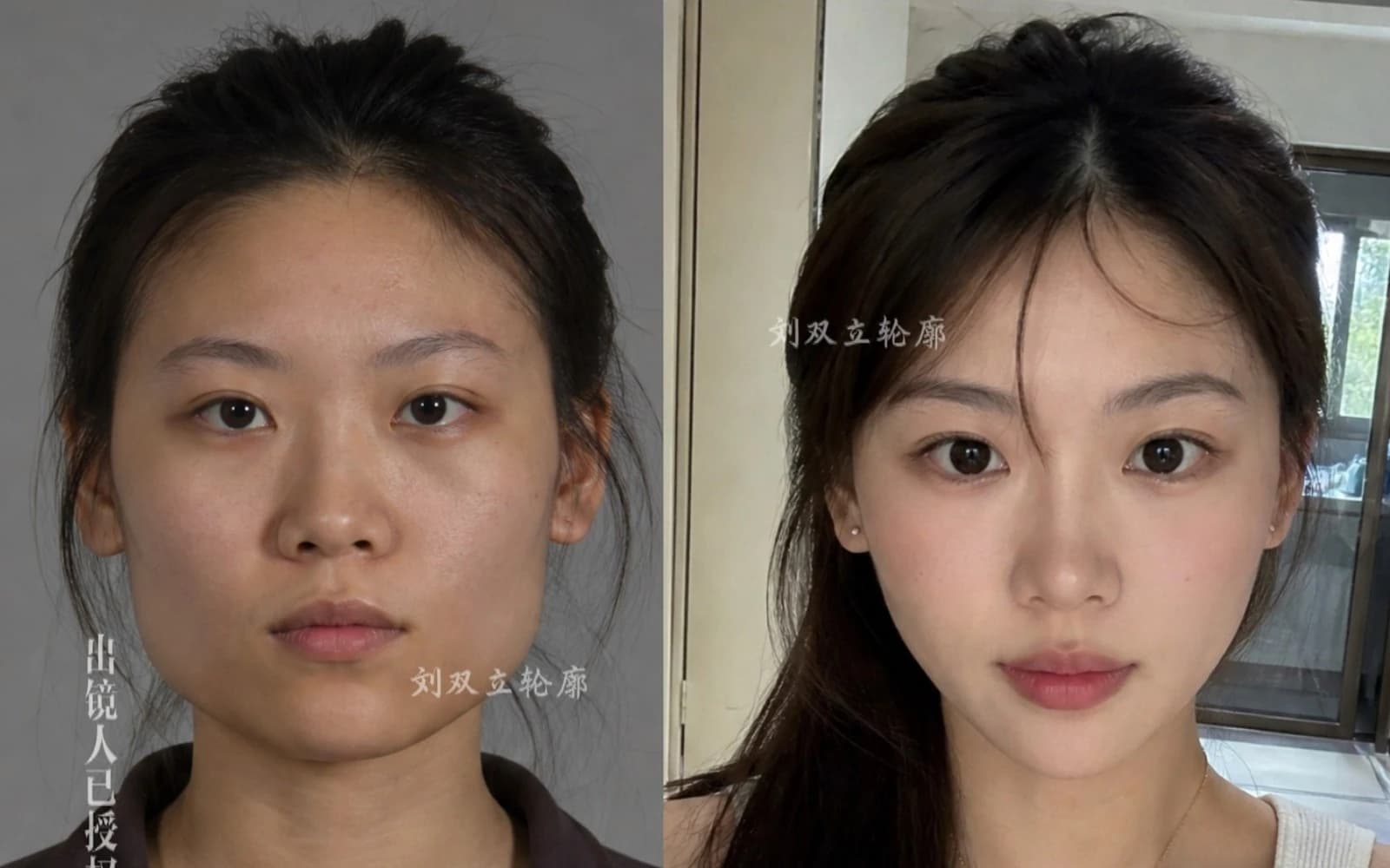 Supplied before and after comparison for Case 06