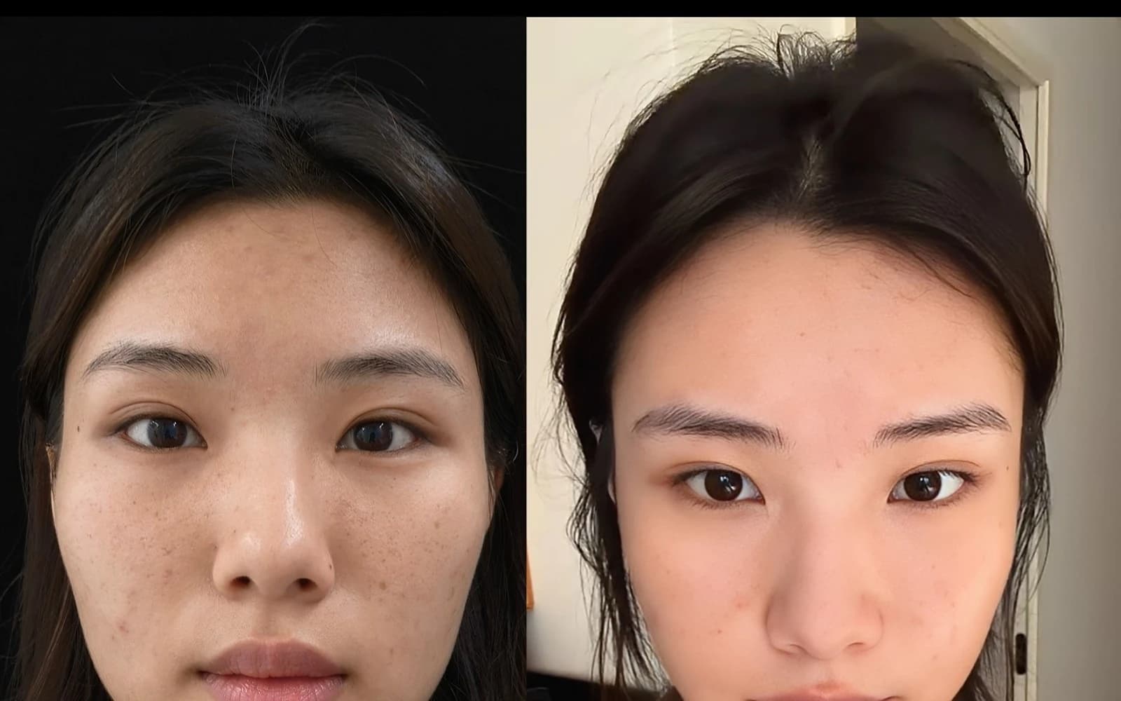 Supplied before and after comparison for Case 07