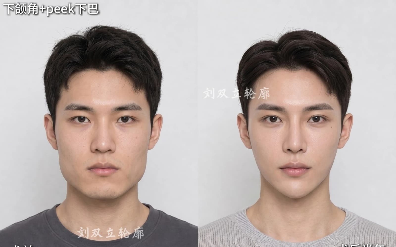 Supplied before and after comparison for Case 09