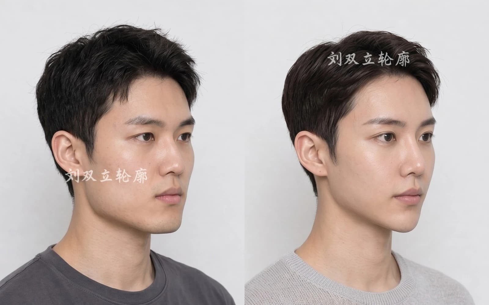 Supplied before and after comparison for Case 10